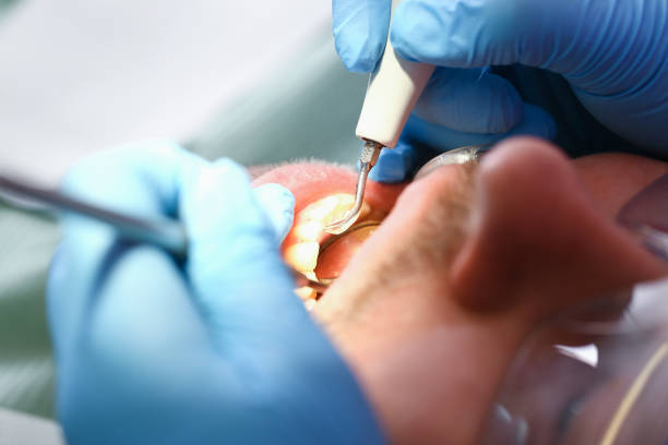 Best Emergency Dental Surgery in New Franklin, OH